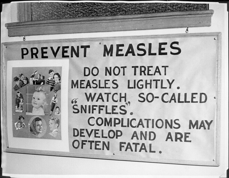 measles bay area awareness